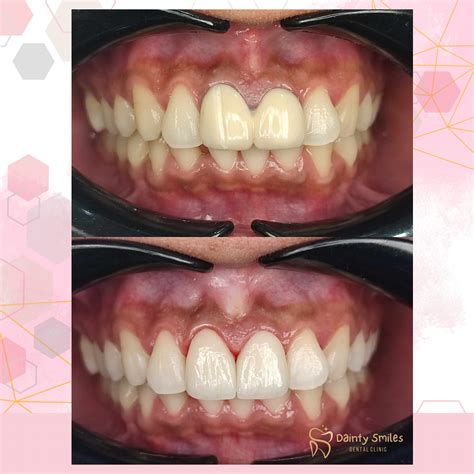 maxicare dental clinics pasig|Dainty Smiles Dental Clinic .